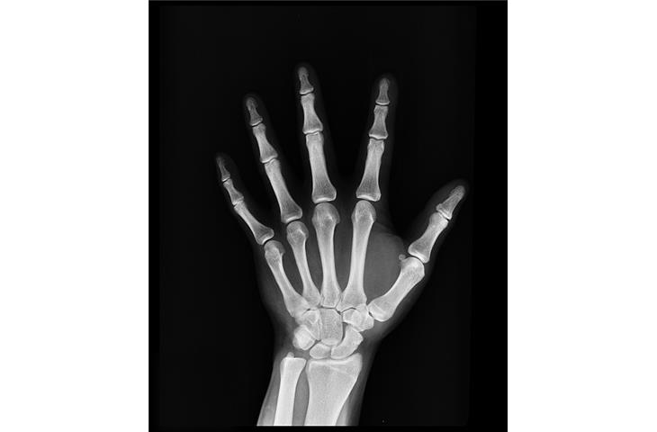 how much do x rays cost without insurance